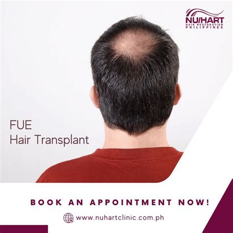 Best Hair Transplant Clinic in the Philippines .